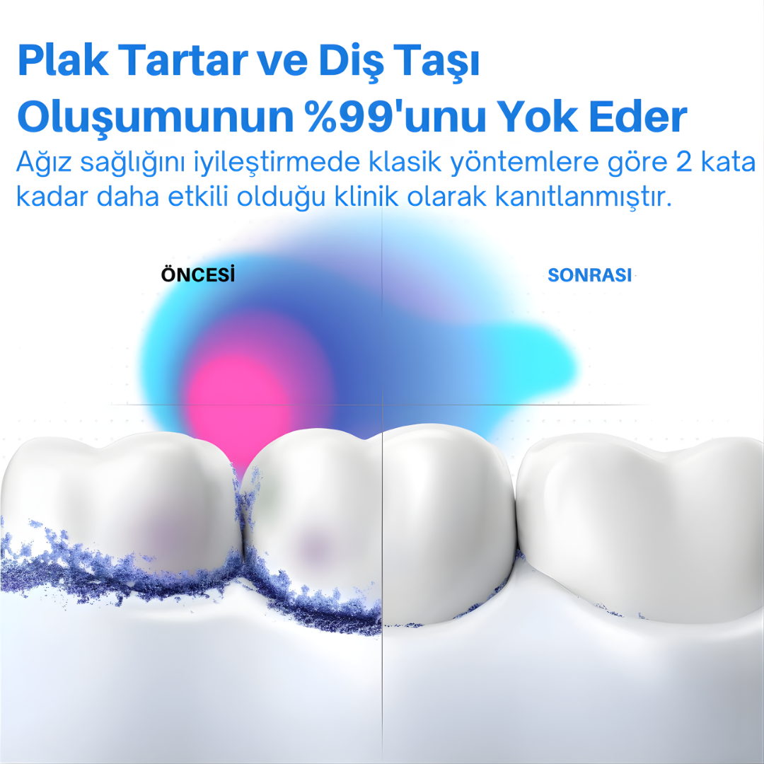Smilezen - Ağız & Diş Temizleme Cihazı